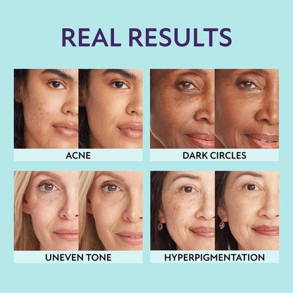 Natravor™ Body Coverage Perfector, All Over Complexion Perfecto, Waterproof and Sweatproof Leg Concealer, Cream Texture Conceals Blemishes, Evens Out Skin Tone,natural radiance